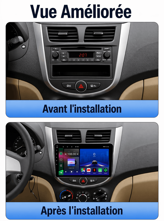Hyundai Accent | 2011-2016 | Head Unit Android 15 | Carplay et Android Auto